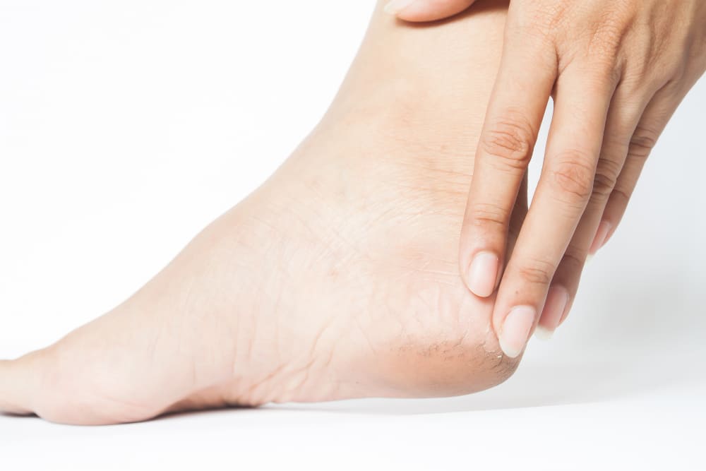 spina calcaneare